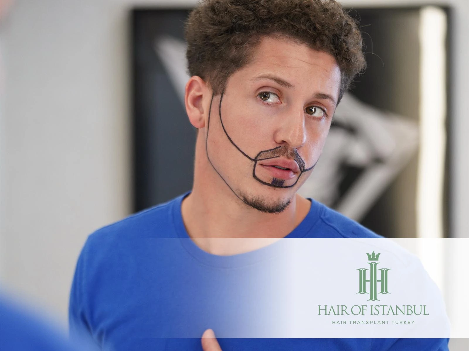 Facial Hair Implants for Natural and Confident Results