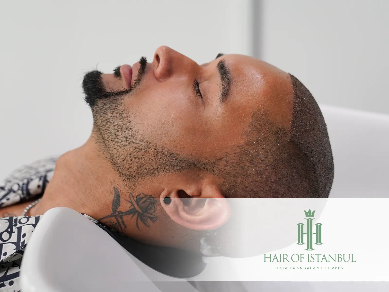 First Wash After Hair Transplant: Step by Step Aftercare Guide