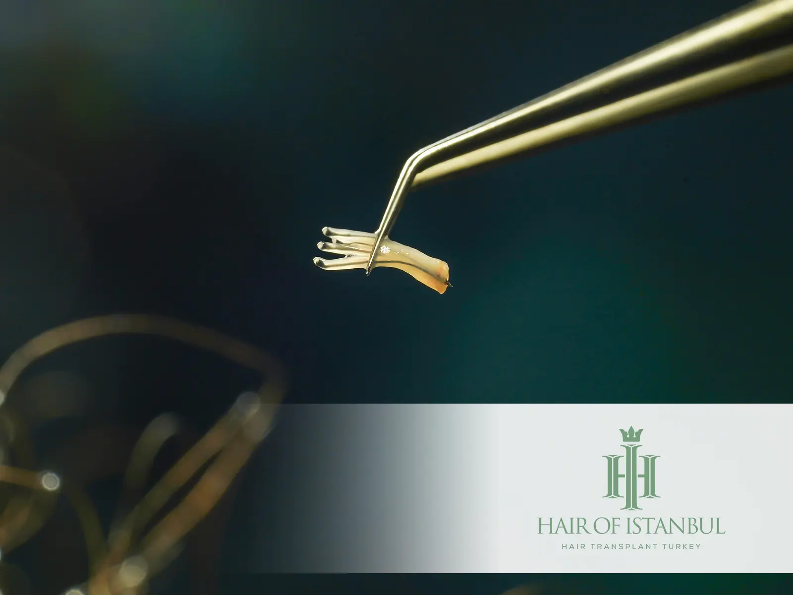 Hair Follicle Health: Strengthen Your Roots for Lasting Hair