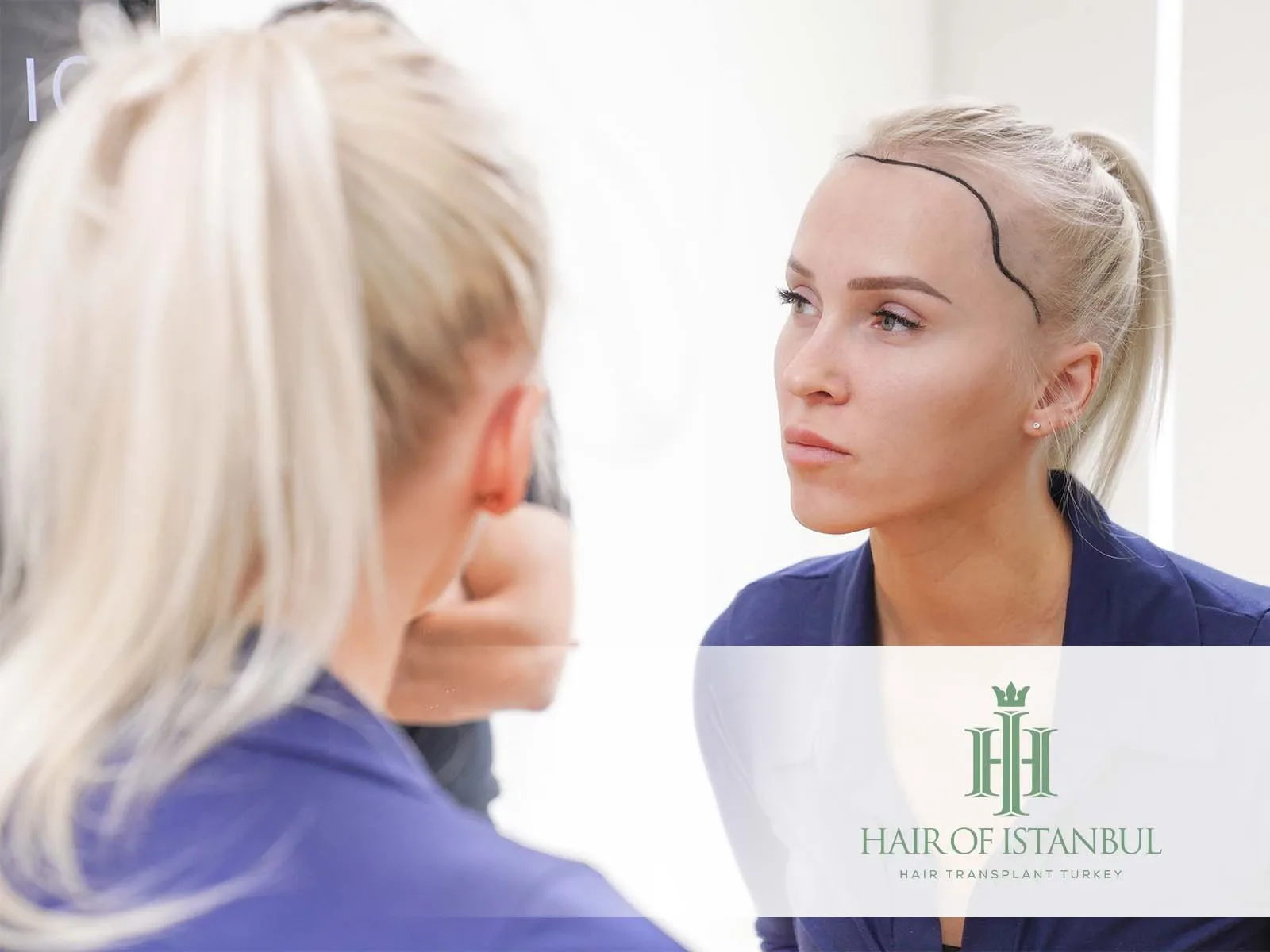 SAÇ ÇİZGİSİ TASARIMI