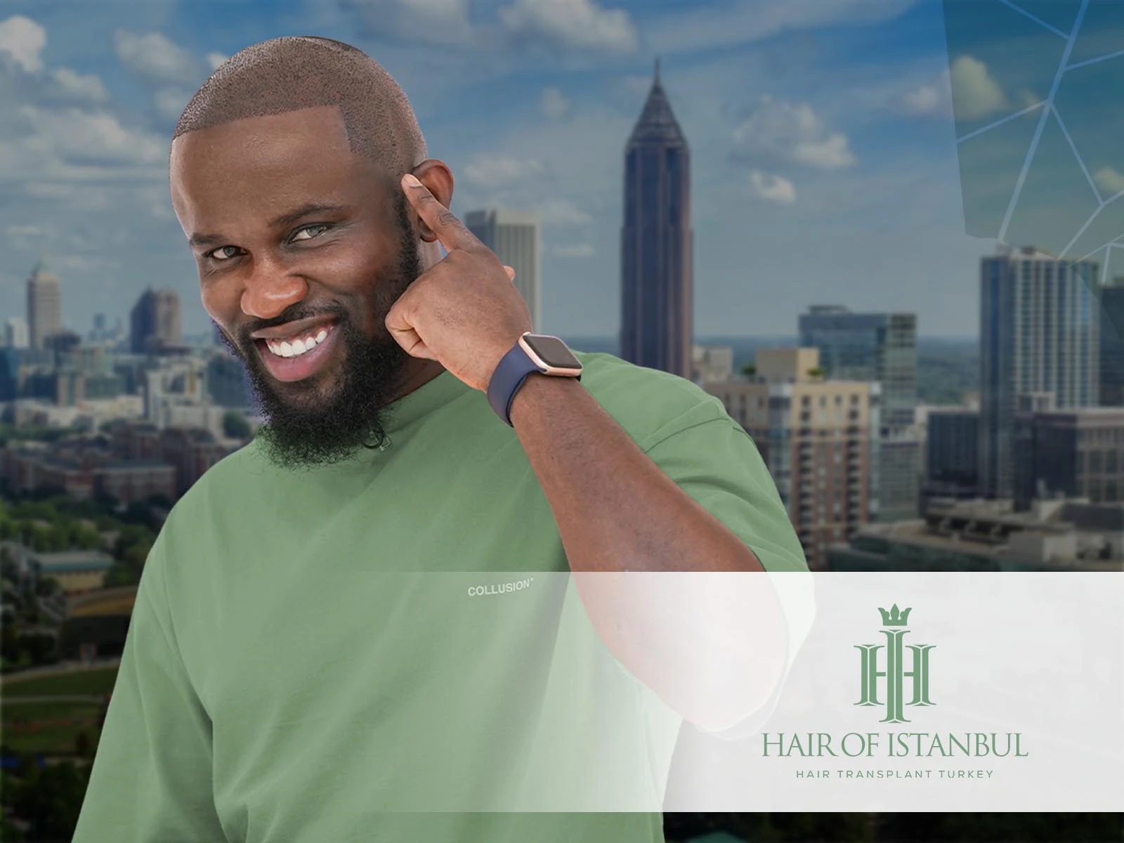 Hair Implants Atlanta Choosing Excellence in Hair Restoration