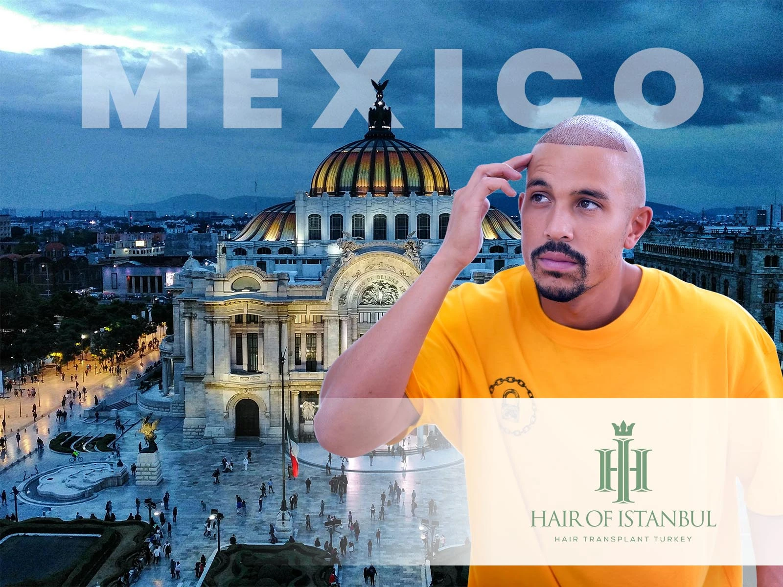 Hair Implants Mexico and the Global Rise of Hair Restoration