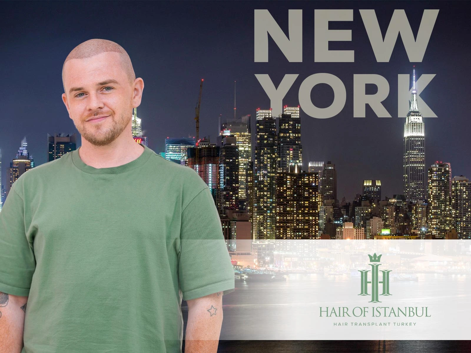 Hair Implants New York: Why More Americans Travel to Istanbul