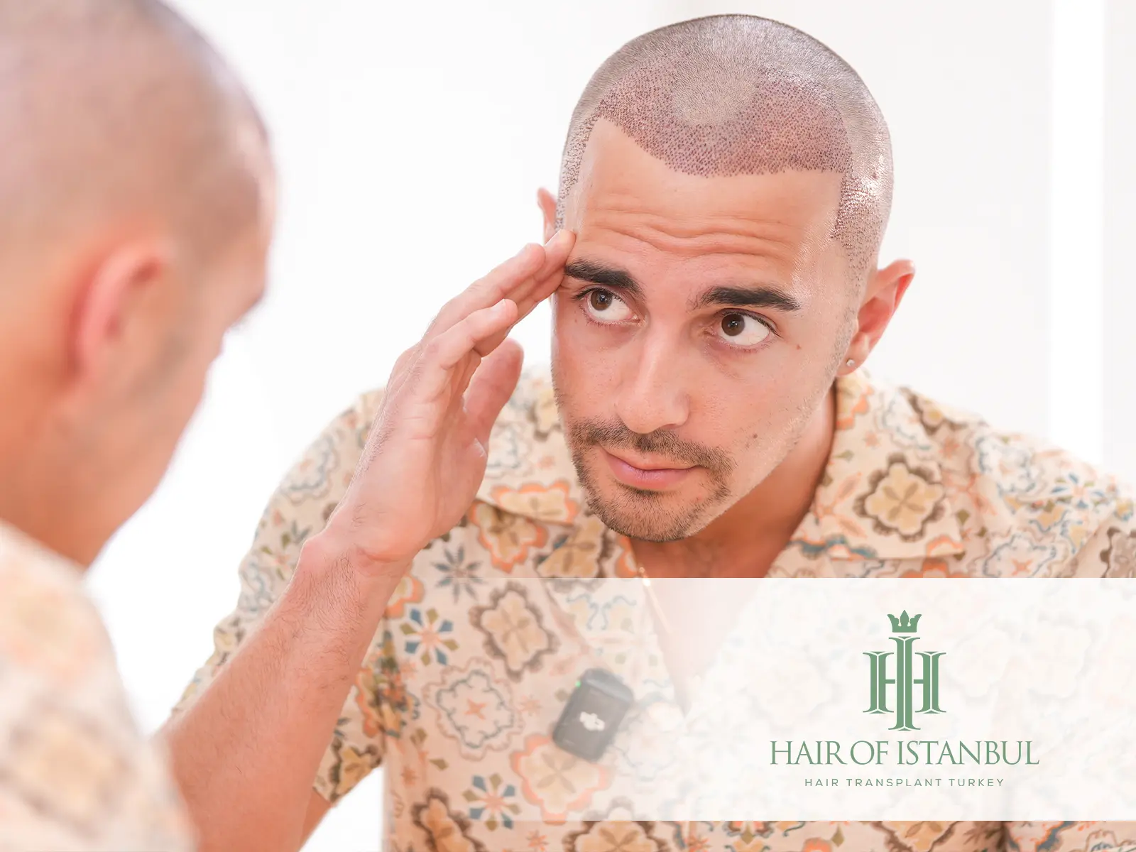 Hair Transplant Comfort and Pain Management: How to Ensure a Smooth Experience