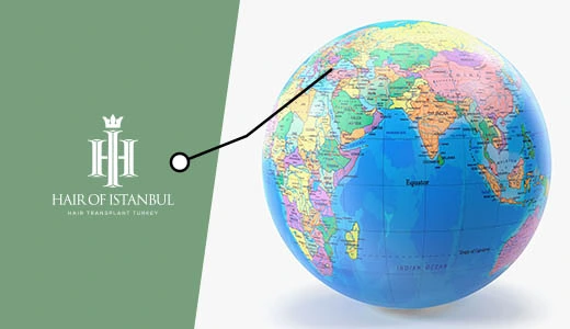 Hair Transplant Istanbul – A Global Destination