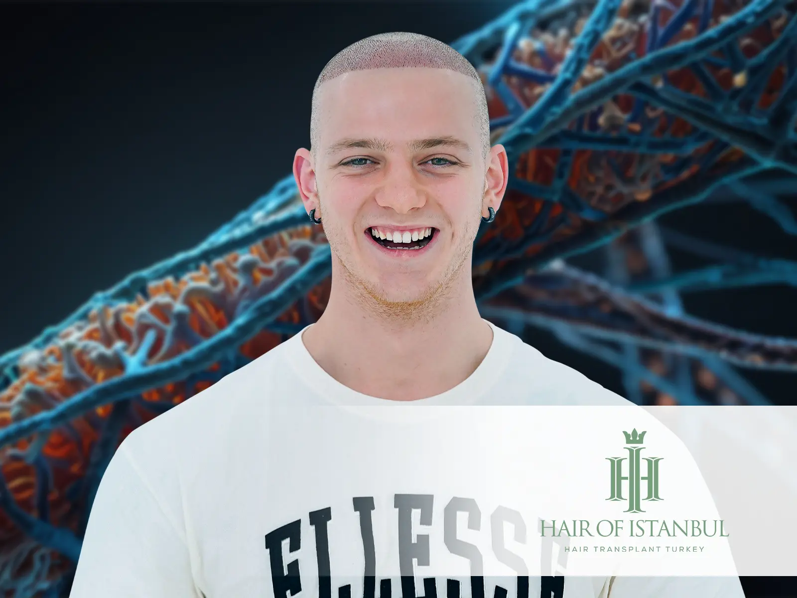 Hair Transplant and Genetic Testing: How Your DNA Impacts Hair Restoration