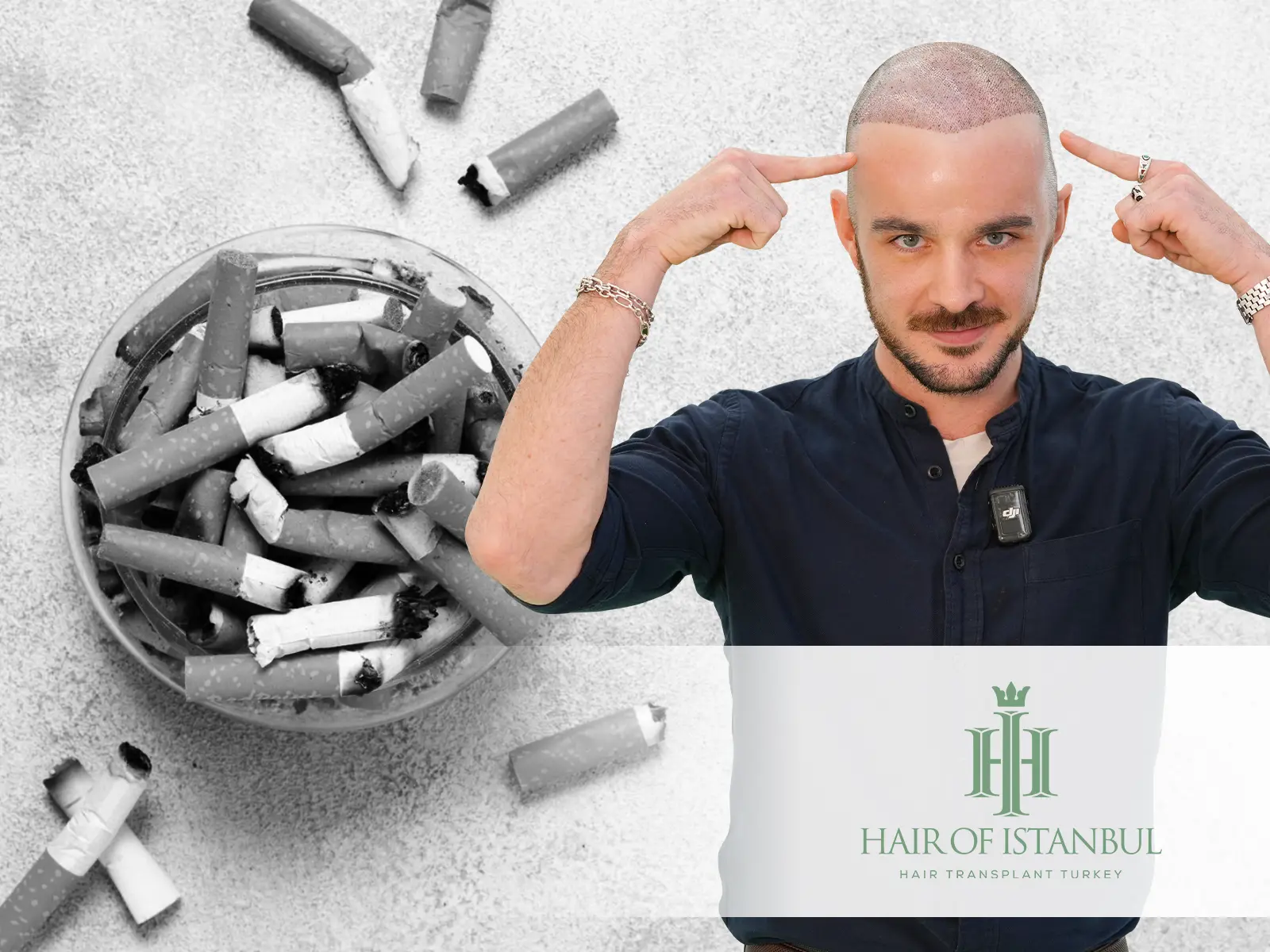 Hair Transplant and Smoking: How Tobacco Affects Hair Restoration