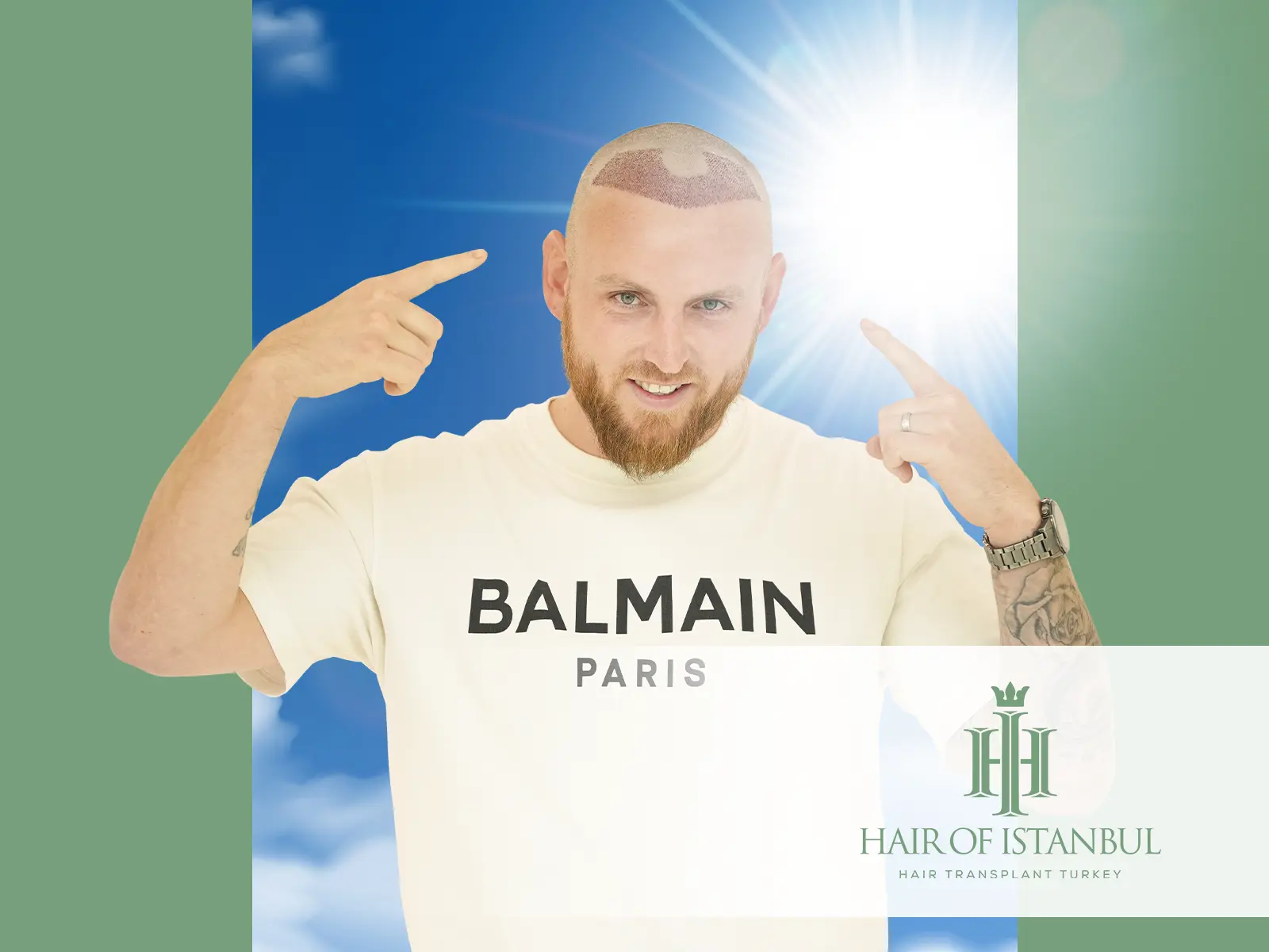 Hair Transplant and Sun Exposure: Protecting Your Results the Right Way
