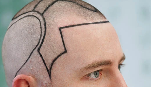 Hair of Istanbul Where Art Meets Science