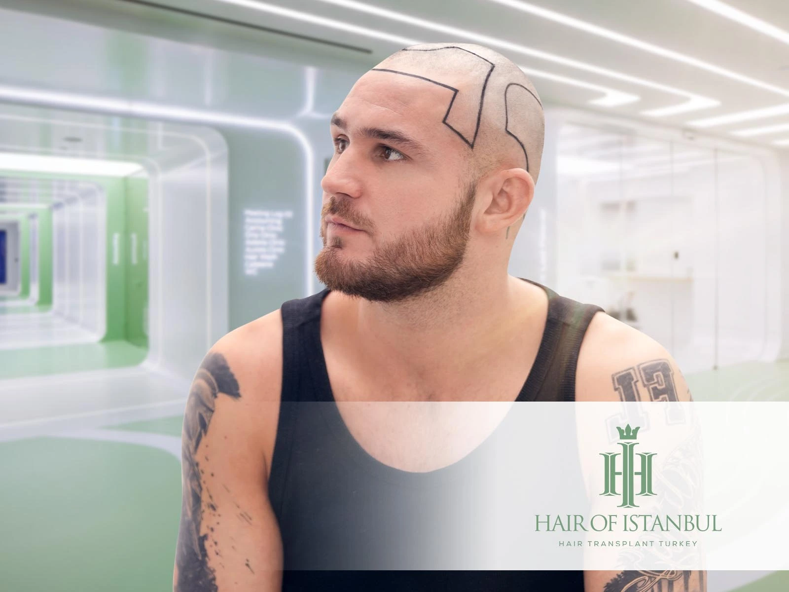 How Do Hair Implants Work: A Comprehensive Look at the Process