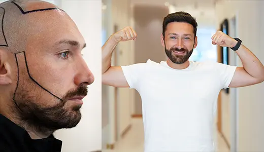 Natural-Looking Results Without Compromise