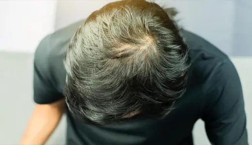 Signs of Weak or Damaged Hair Follicles