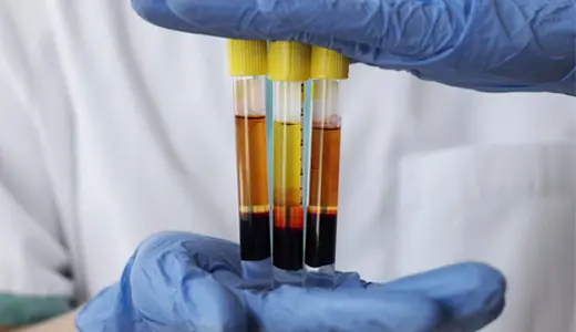 What Is PRF and Why It Matters