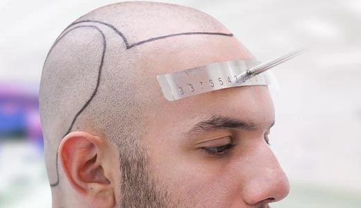 What Makes Hair of Istanbul Different