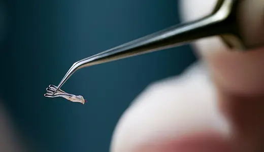 What Makes Micro Hair Transplant Techniques Different