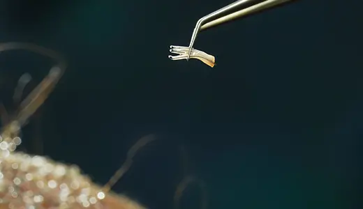 Why Hygiene Standards Are Non-Negotiable in Hair Transplantation