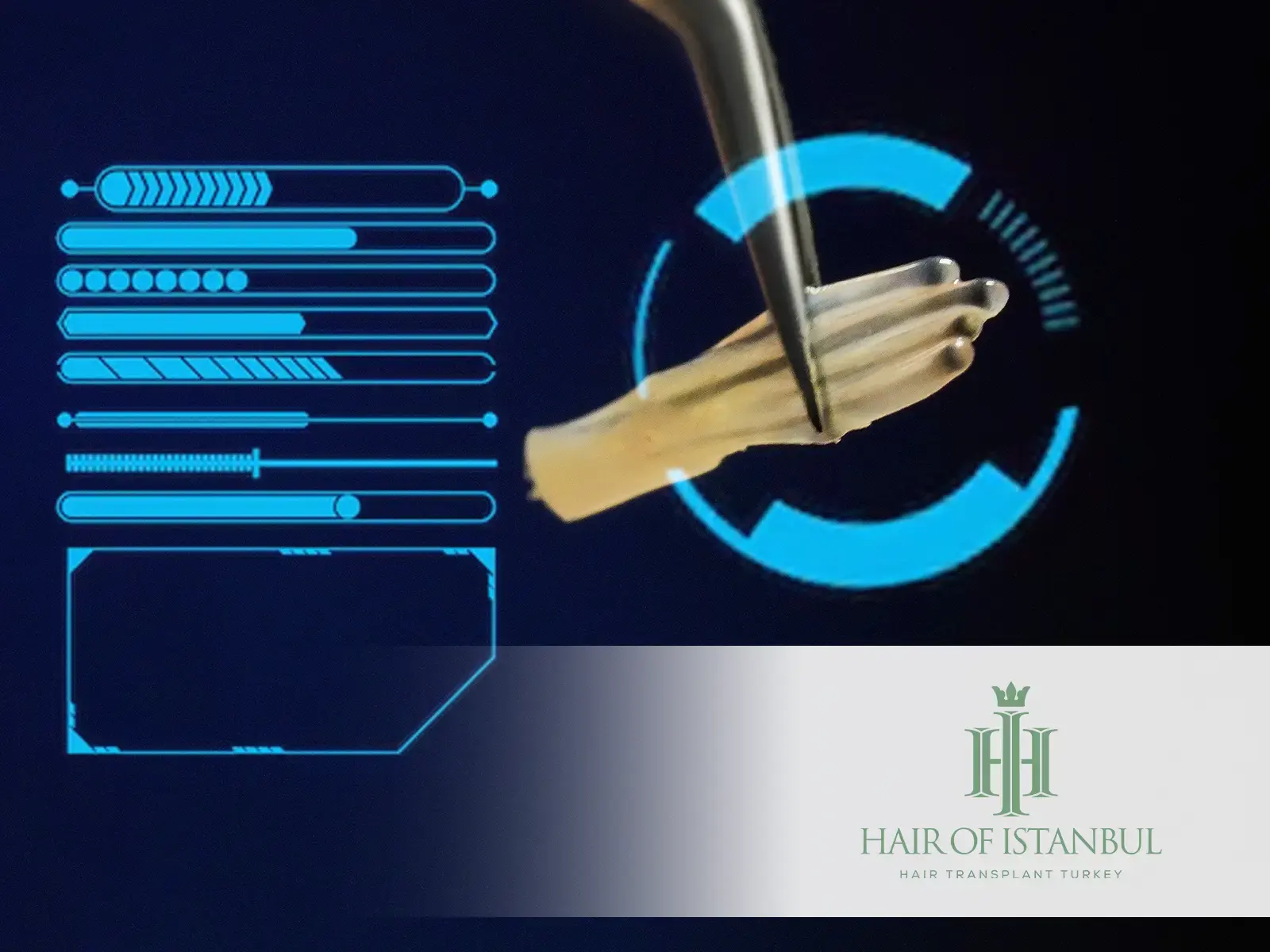 Pre-Hair Transplant Follicle Analysis The First Step Toward a Successful Procedure