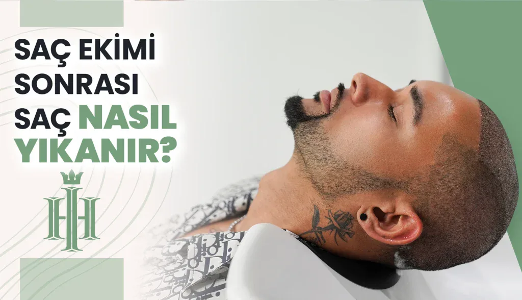 Saç Ekimi Sonrası Bakım Talimatları 1 Saç ekimi sonrası saç yıkama işlemi