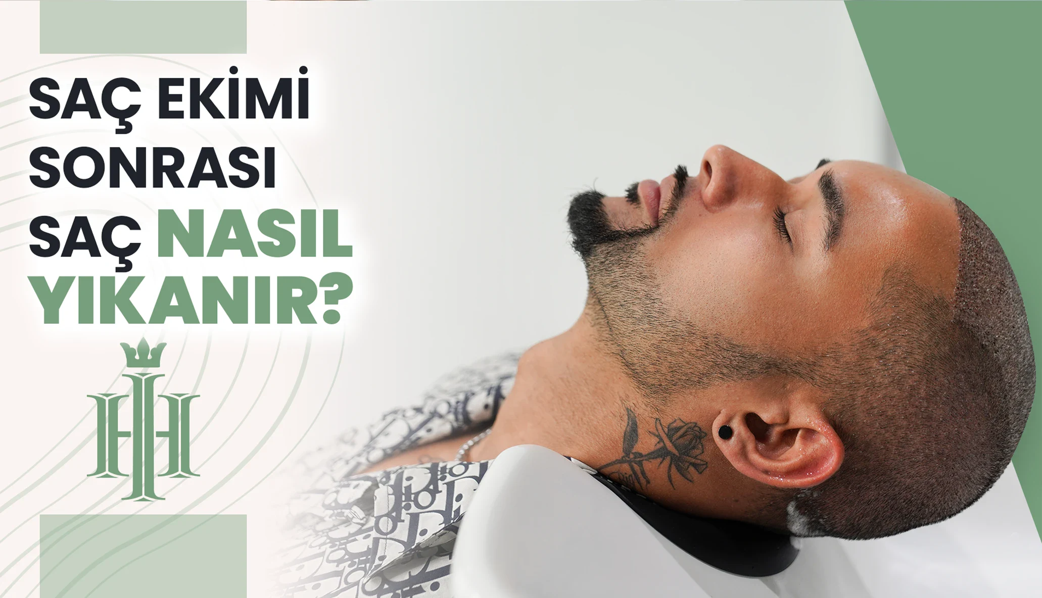 SAÇ EKİMİ SONRASI SAÇ YIKAMA