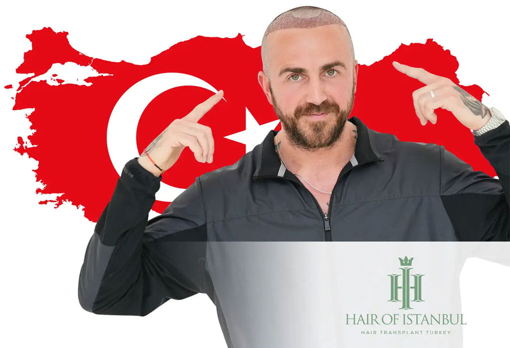 Hair Transplant in Turkey 5 hair transplant packages in turkey