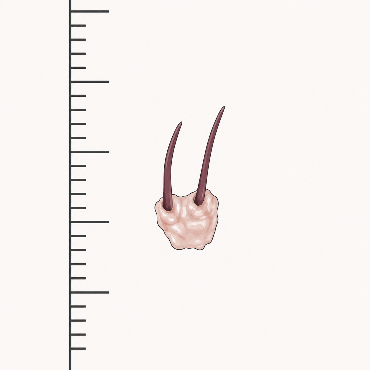 What a Dislodged Hair Graft Looks Like — and What It Does Not 2 Close-up of a dislodged hair graft: a 1-2 mm fragment of pale tissue with two short hairs attached, shown beside a ruler for scale