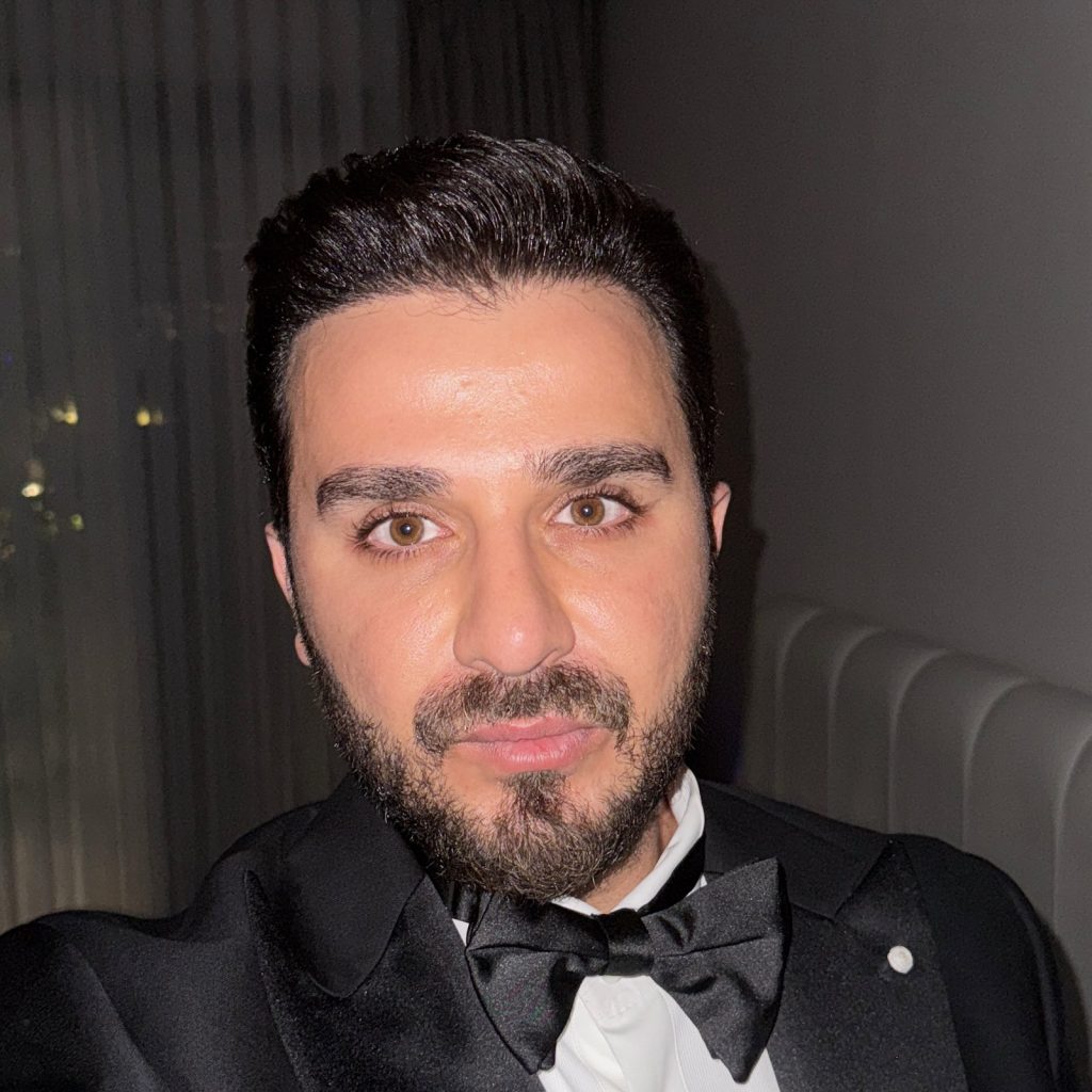 Hair transplant result, 4,500 grafts, Month 10 — Hair of Istanbul