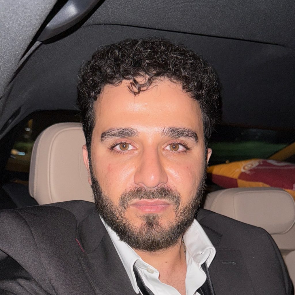 Hair transplant result, 4,500 grafts, Before & After (3) — Hair of Istanbul