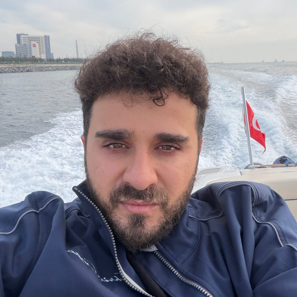 Hair transplant result, 4,500 grafts, Month 15 — Hair of Istanbul