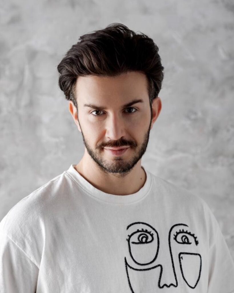 Saç ekimi sonucu, 3.000 greft, 12. ay (4) — Hair of Istanbul