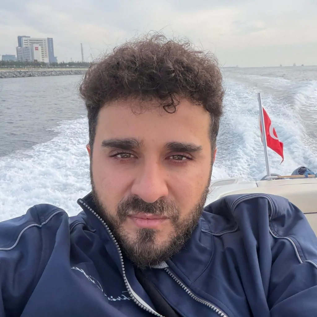 Before & After 292 Hair transplant result, 4,500 grafts, Month 15 — Hair of Istanbul