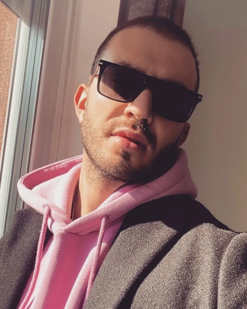 Before & After 7 Hair transplant result, 3,000 grafts, Month 3 — Hair of Istanbul