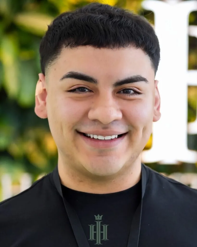 Before & After 82 Hair transplant result, 5,800 grafts, Year 2 — Hair of Istanbul